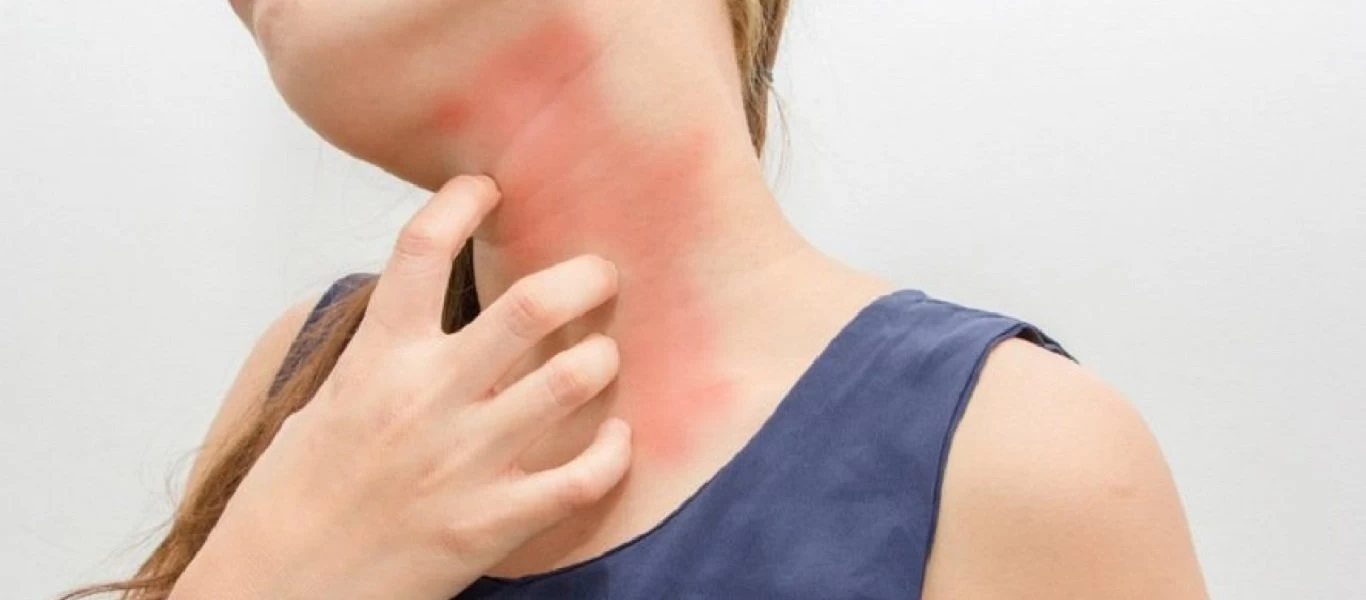 Με αυτό το φρούτο θα πείτε «τέλος» στις δερματικές αλλεργίες
